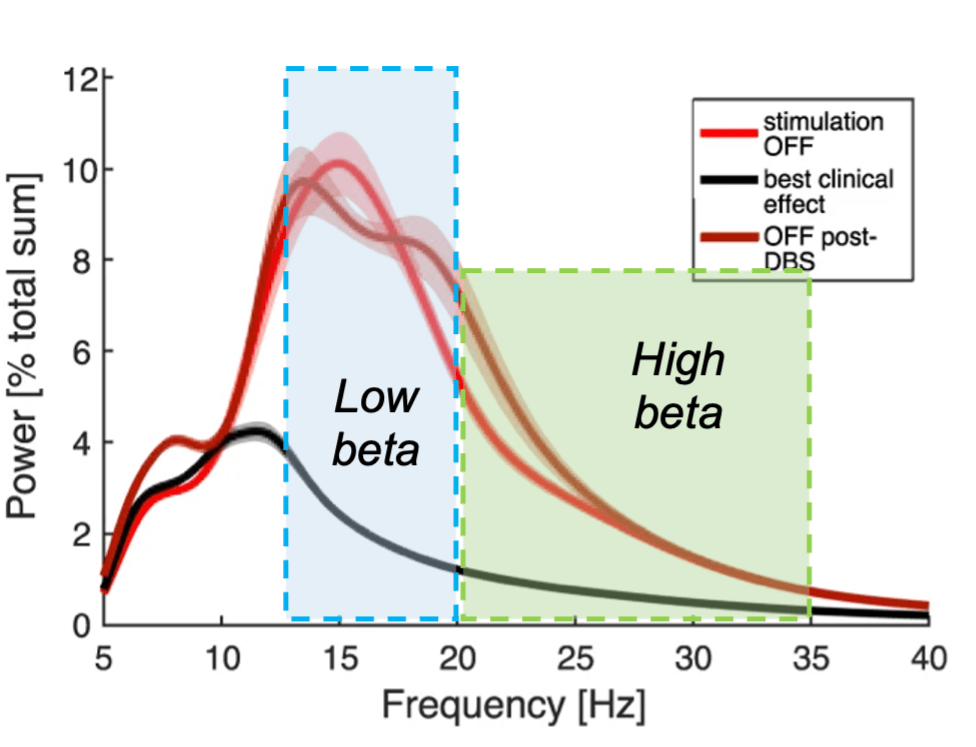 A graph with frequency (in Hertz) on the x axis and power (strength of oscillations) on the y axis. Black and red lines indicate the amount of power in low beta and high beta frequency bands with or without DBS, respectively. A blue shaded box indicates the frequency range of low beta and a green shaded box indicates the frequency range of high beta.